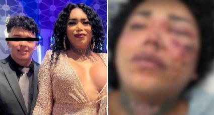 Novio de Paola Suárez “se disculpa” por agresión a la influencer