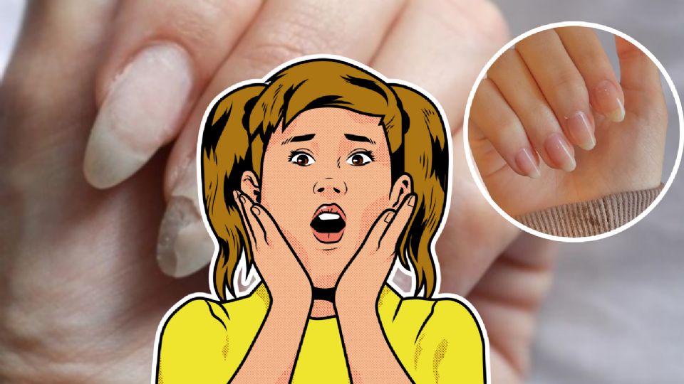 Tener las uñas rotas puede ser señal de algo malo en el cuerpo