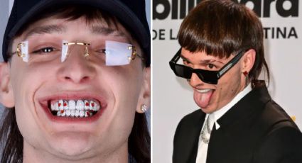 ¿Qué son los grillz como los que usa Peso Pluma? Conoce si pueden dañar tus dientes	