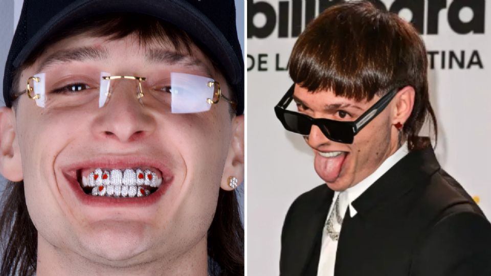 Peso Pluma y sus famosos grillz  en los dientes