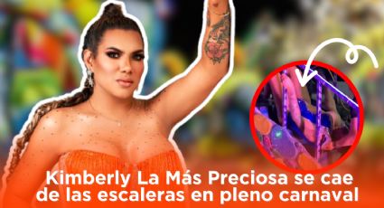 Kimberly La Más Preciosa: ¿Cómo está luego de haberse caído de las escaleras en pleno carnaval?