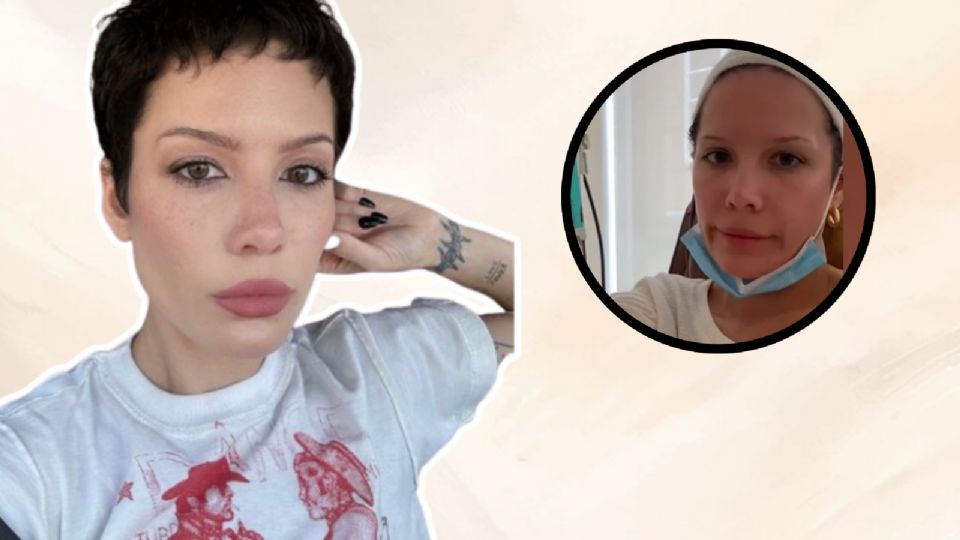 Halsey lupus y leucemia